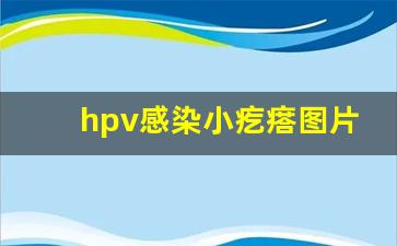 hpv感染小疙瘩图片_小阴脣内侧长小籽籽